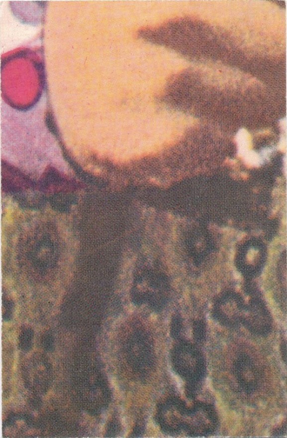 75b92